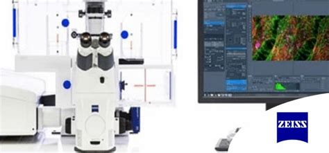 ZEISS Airyscan: Optimizing usage for fast, gentle, super .